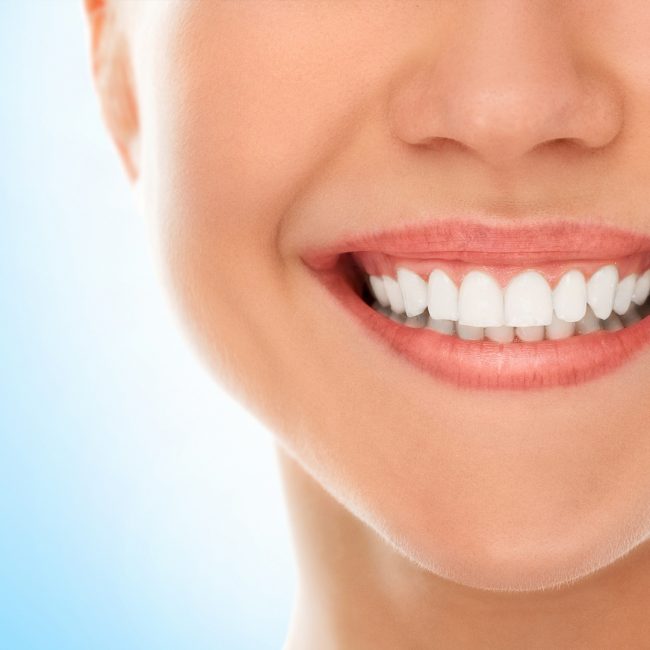 Dental Implant 8 08 Teeth implant 01