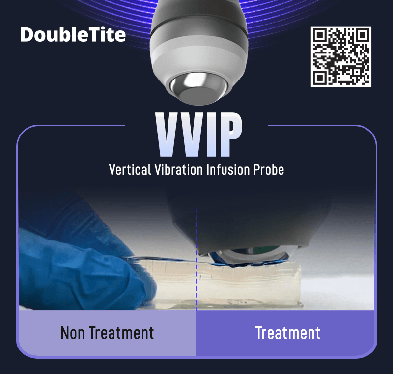 vvip2