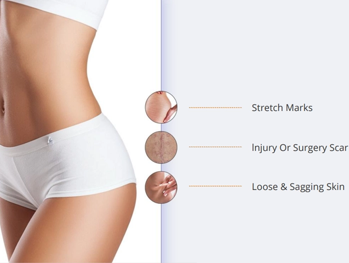 advanced microneedling pinxel v