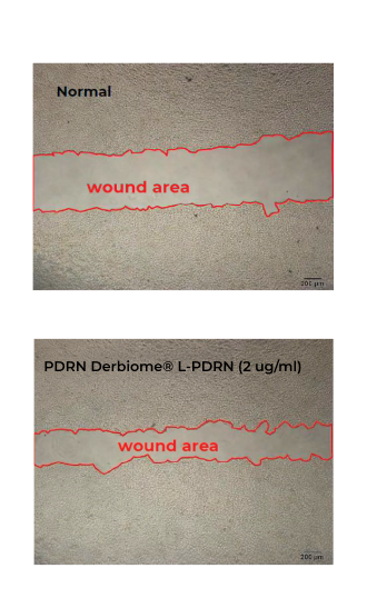 image pdrn right